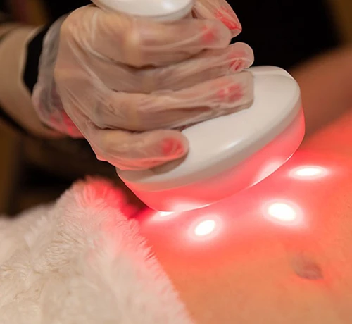 PWShape alakformáló kezelés modern technológiával a test formálására Kapuváron