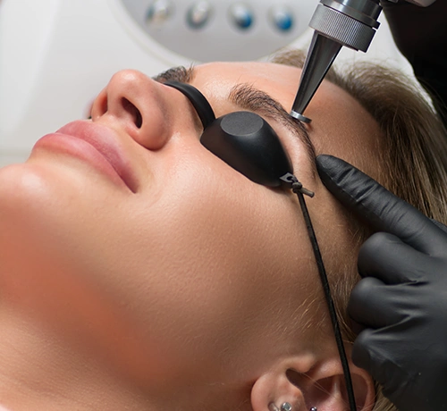 Lézeres tetoválás eltávolítás, tetoválás, lézer, személyes konzultáció, utóápolás, Kapuvár