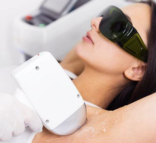 Orvosi IPL szőrtelenítés, tartós szőrtelenítés, szőr, szőrszál, Kapuvár