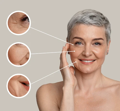 UTIMS Hifu, szemöldök emelés, toka lifting, ránccsökkentés, arckontúr emelés, Kapuvár