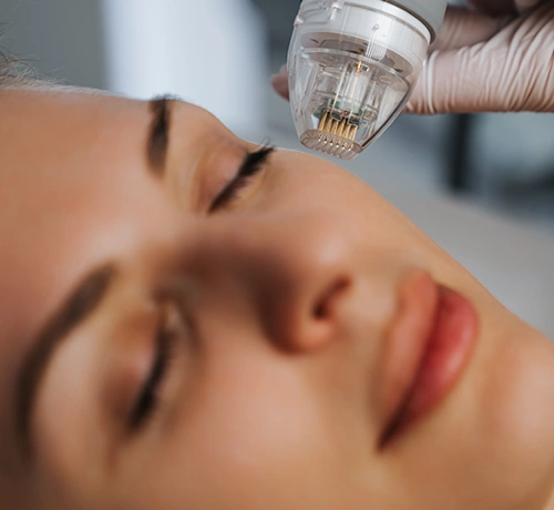 Vace mikrotűs rádiófrekvenciás kezelés, ampulla, k-vitamin, feszesítés, Kapuvár