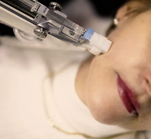 VT Injektor, mikrotűs mezoterápia, mikrotűs technológia, arcfiatalítás, Kapuvár